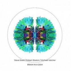 Brain in a Dish